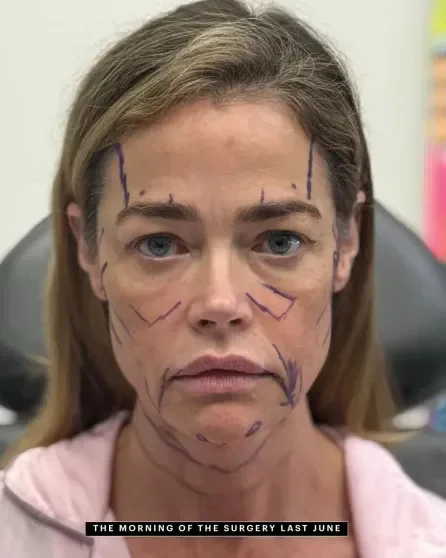 Дениз Ричардс показала лицо после пластики: «Вернула себе лицо из 90-х»