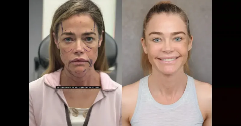 Дениз Ричардс показала лицо после пластики: «Вернула себе лицо из 90-х»