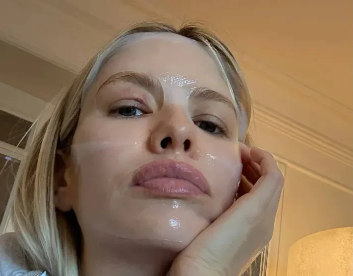 Елена Перминова получила ожог от косметики и ушла в затворничество