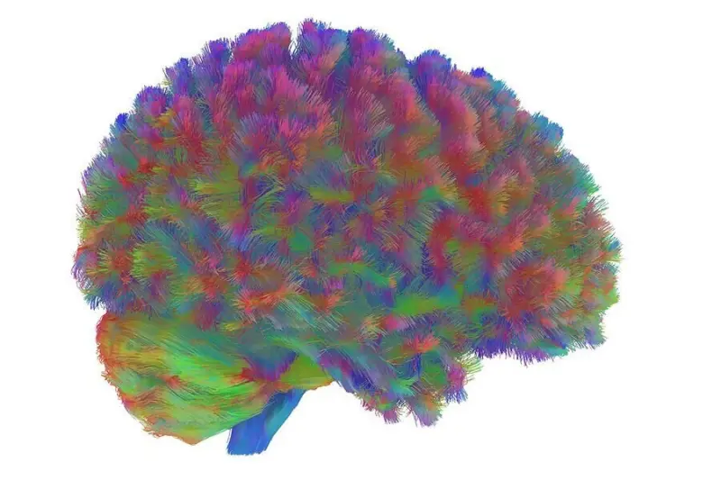 Изображение человеческого мозга