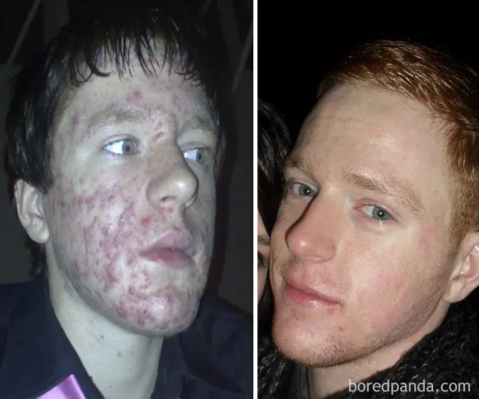 Фото до и после, демонстрирующее позитивные изменения