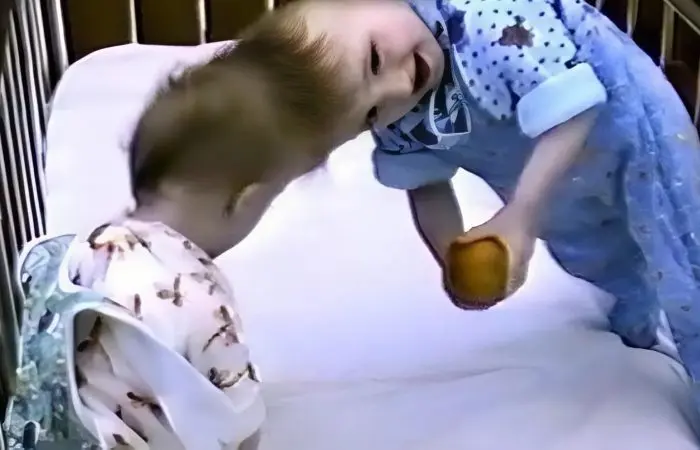 Две жизни, одна голова: Как советские врачи подарили сестрам Тамулявичюте право на отдельную судьбу