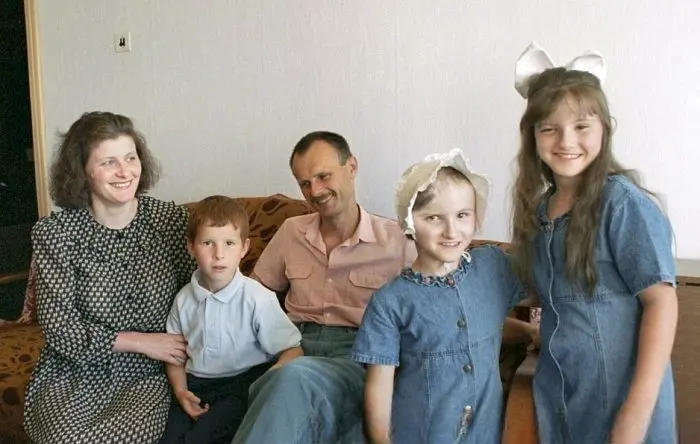 Две жизни, одна голова: Как советские врачи подарили сестрам Тамулявичюте право на отдельную судьбу