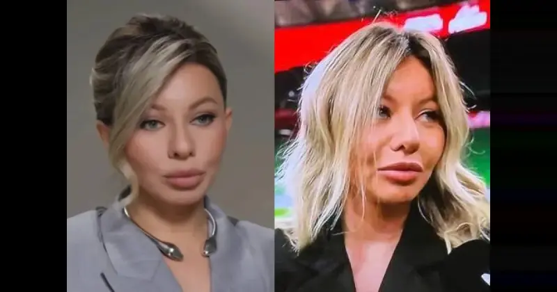 Надежда Стрелец без фильтров: публика шокирована разницей после пластики