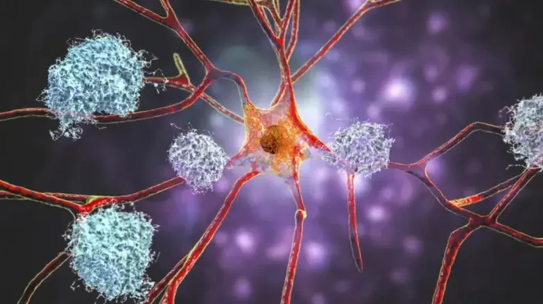 Альцгеймер — это не старость: что на самом деле убивает мозг и как это остановить