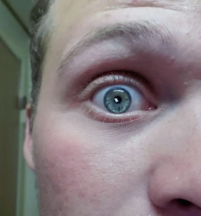 Контактная линза, залитая краской