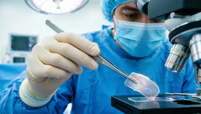 Как в израильской клинике Сураски лечат рак кожи: новые технологии и проверенные протоколы Проведение микрографической операции по методу Моса в клинике Сураски для удаления опухоли кожи