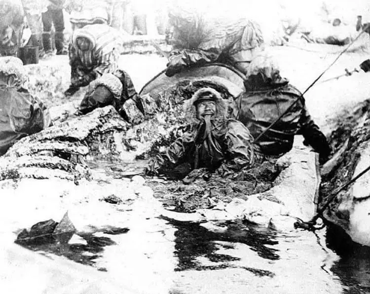 Безумная медицина: 13 шокирующих методов лечения из прошлого