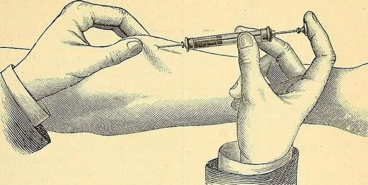 Безумная медицина: 13 шокирующих методов лечения из прошлого