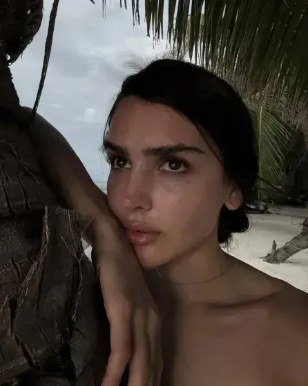 Дина Саева показала нос после операции и снова заявила: «Не ради эстетики»