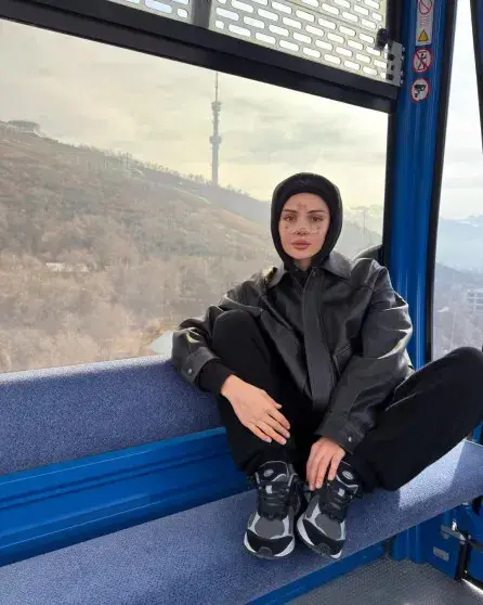 Дина Саева показала нос после операции и снова заявила: «Не ради эстетики»