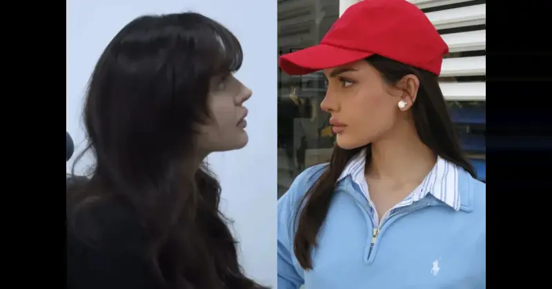 Дина Саева показала нос после операции и снова заявила: «Не ради эстетики»