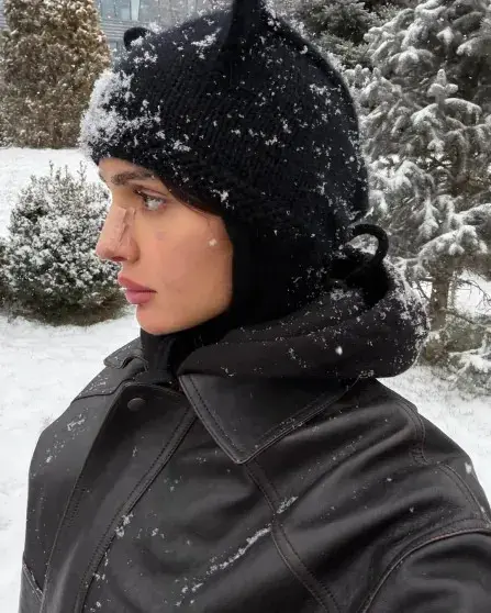 Дина Саева показала нос после операции и снова заявила: «Не ради эстетики»