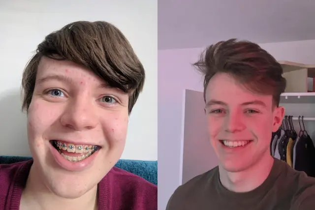 20 фото гадких утят, ставших прекрасными лебедями: вдохновляющие преображения С 15 до 18 лет