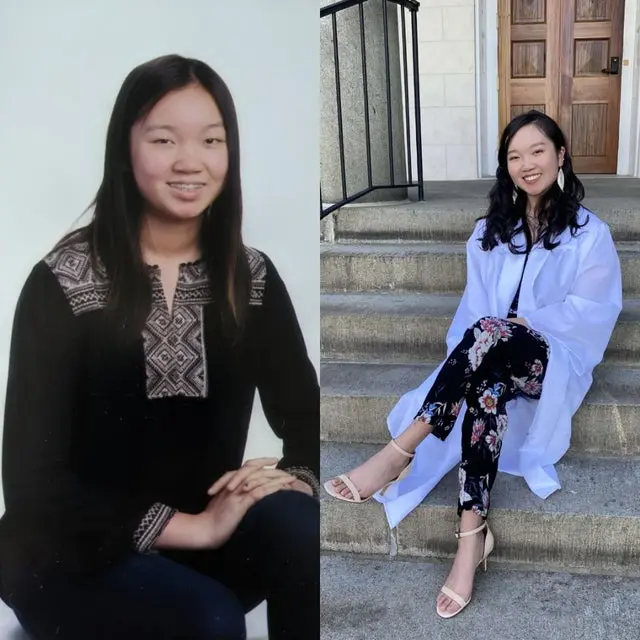 20 фото гадких утят, ставших прекрасными лебедями: вдохновляющие преображения Парень в 13 и 18 лет