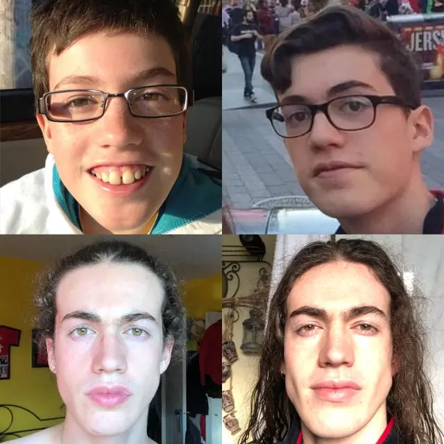 20 фото гадких утят, ставших прекрасными лебедями: вдохновляющие преображения С 12 до 20 лет