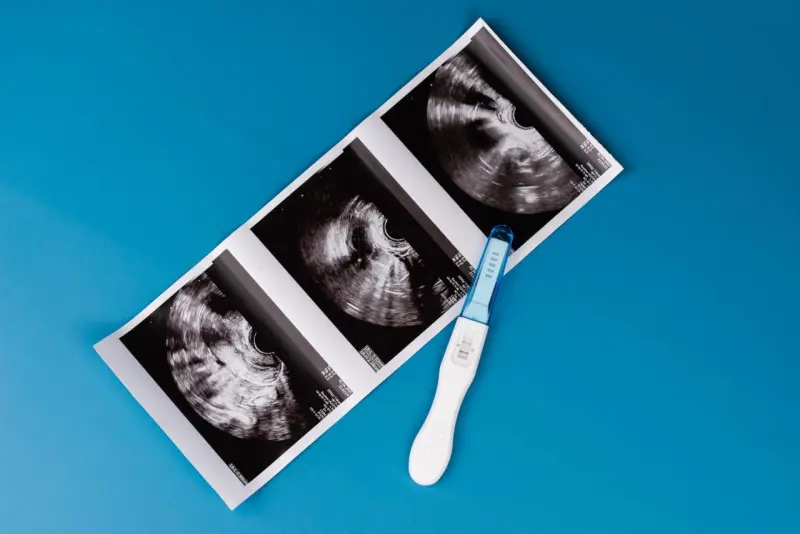 Невидимая потеря: что такое биохимическая беременность и почему о ней часто не знают