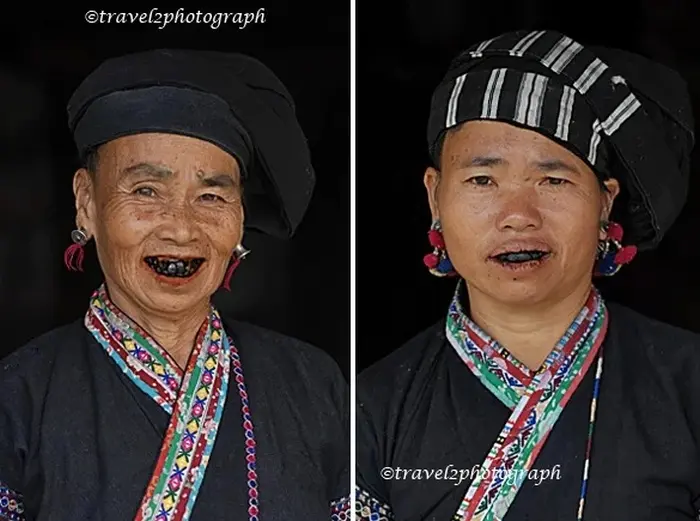 Черные зубы навсегда: зачем подростки из народа Буланга проходили жестокий обряд