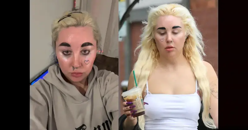 Аманда Байнс преобразилась: минус 14 кг на Оземпике