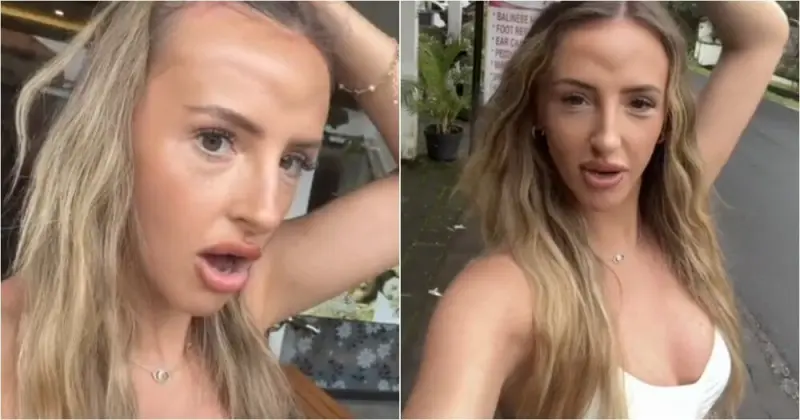 Кошмар на Бали: как вечеринка превратила девушку в мультяшного монстра