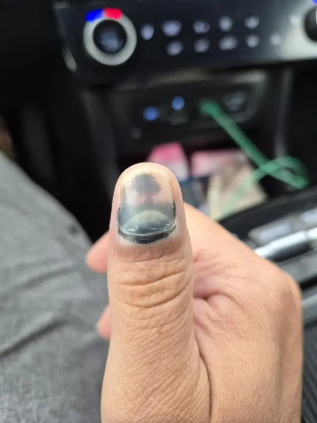 Когда мир притворяется: 20 фото, доказывающих, что парейдолия повсюду