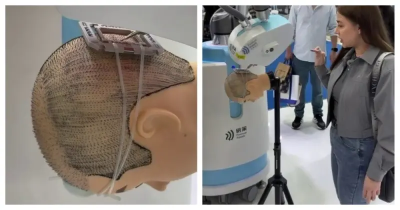 Робот-хирург для пересадки волос показали на выставке в Китае робот, пересадка волос, Китай, выставка, технологии, видео
