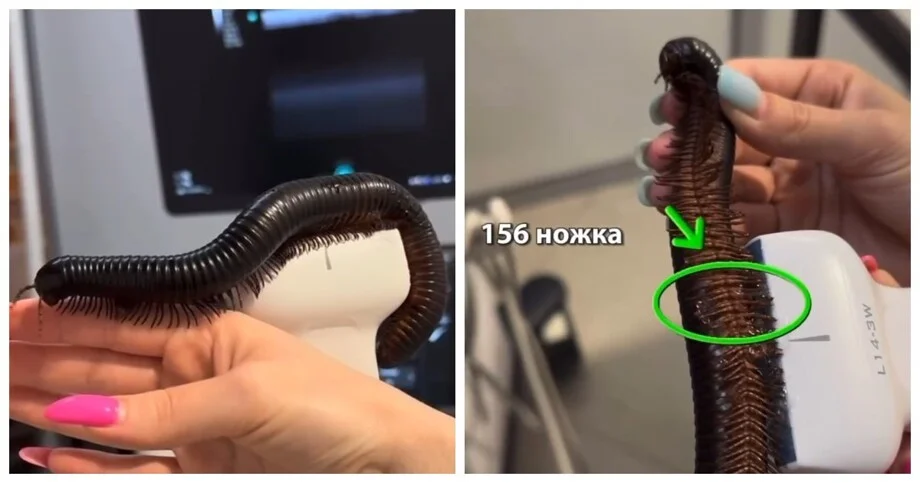 Аркаша на больничном: многоножка повредила ножку многоножка, экзотические питомцы, ветеринария, клиника, Аркаша, УЗИ, забавное