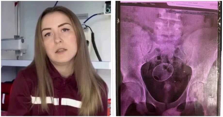 Яйцо не там: 16-летний экспериментатор попал в больницу Яйцо не там: 16-летний экспериментатор попал в больницу подросток, яйцо, больница, медицина, шок, курьез